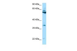 TMEM192 Rabbit anti-Human, Polyclonal, Novus Biologicals 0.1ml; Unconjugated:Antibodies,